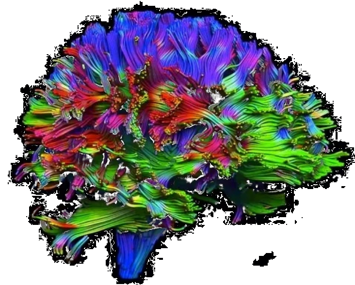 A colorful illustration of a human brain